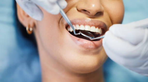 Best Emergency Tooth Extraction in Belleville, PA